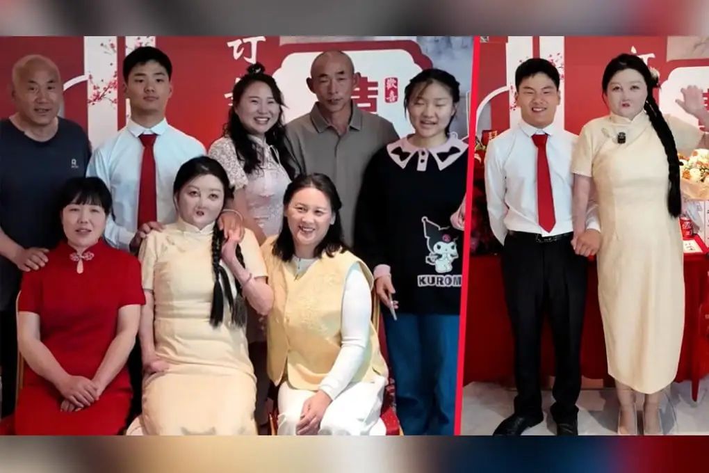 A woman in China who suffered horrific burns in a kitchen fire when she was young has revealed that she and her fiance share the same birthday. Photo: SCMP composite/Douyin