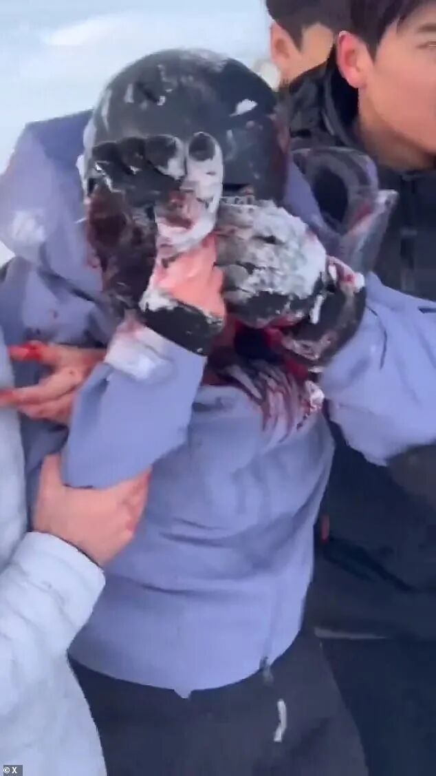 The woman was left seriously injured after the attack in the Talat village area of the Keketuohai UNESCO Global Geopark in Fuyun County, northern China, at around 7pm on Friday