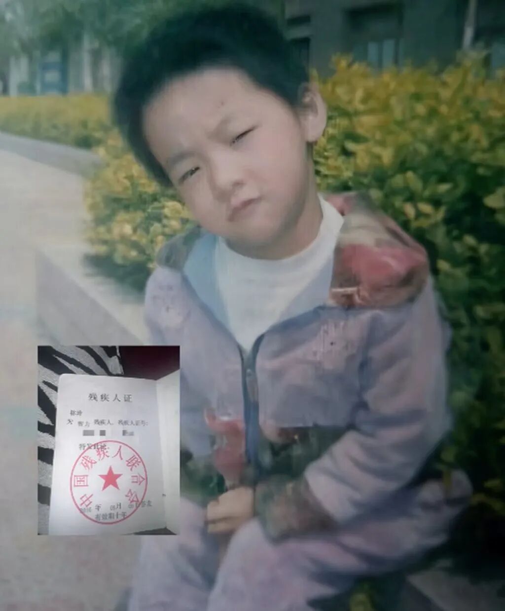 Lin Ling poses for a photograph as a little girl. She was diagnosed with jaundice at birth. Photo: Douyin