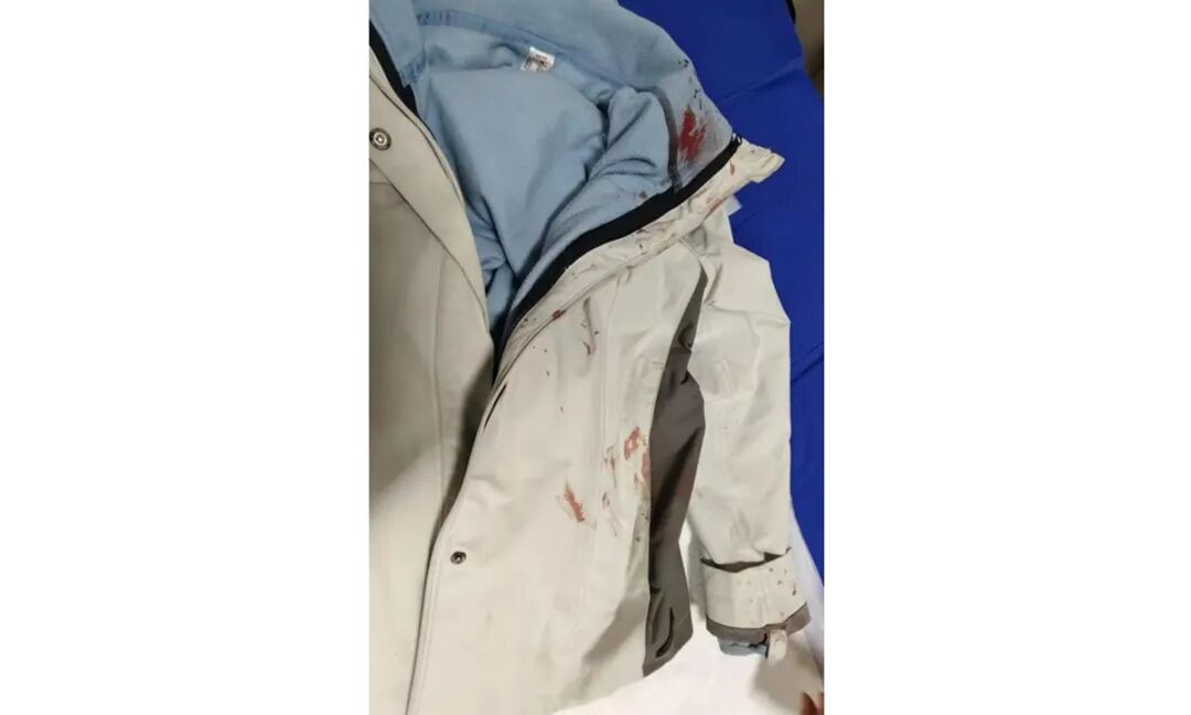 The clothes Wang wore that day bares bloodstains from the injuries she sustained while subduing the assailant Photo: Screenshot from media reports