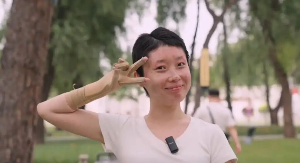 Tong is still recovering from her injuries but always puts on a brave face for her parents. Photo: Handout