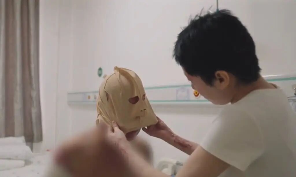 Tong helps her father put on a special mask which helps him recover from the severe burns he suffered to his face. Photo: Handout