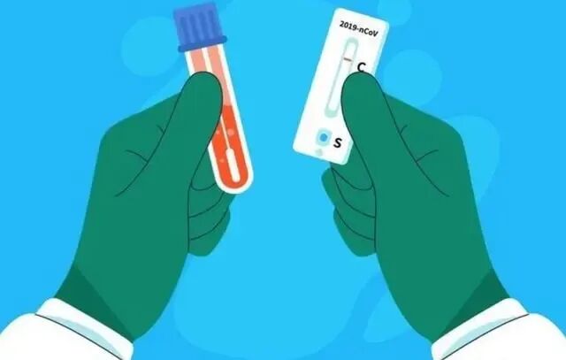 流感病毒怎么采样流感高发季，“甲乙流核酸检测”为您护航！_https://www.jmylbn.com_新闻资讯_第5张