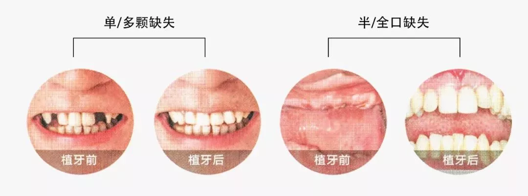 东莞哪个口腔医院更靠谱？为什么说年前看牙首选康达口腔？给你六个理由