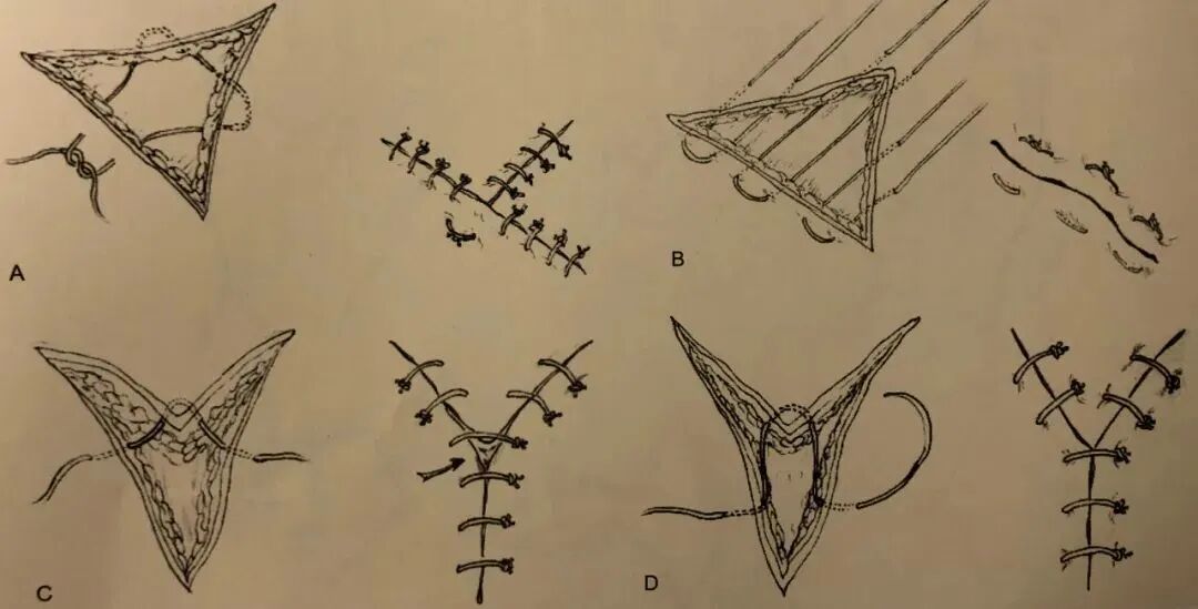 为什么要结扎血管谈骨论筋丨最全的外科手术基本功，别怪我没告诉你！_https://www.jmylbn.com_新闻资讯_第33张
