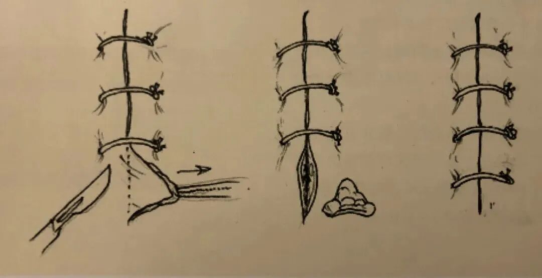 为什么要结扎血管谈骨论筋丨最全的外科手术基本功，别怪我没告诉你！_https://www.jmylbn.com_新闻资讯_第32张