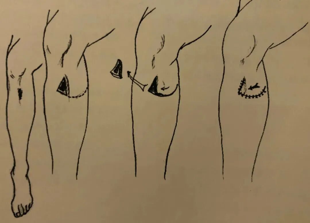 为什么要结扎血管谈骨论筋丨最全的外科手术基本功，别怪我没告诉你！_https://www.jmylbn.com_新闻资讯_第36张