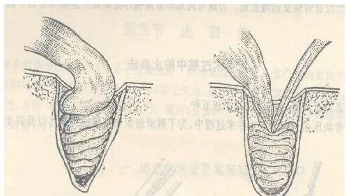 为什么要结扎血管谈骨论筋丨最全的外科手术基本功，别怪我没告诉你！_https://www.jmylbn.com_新闻资讯_第27张