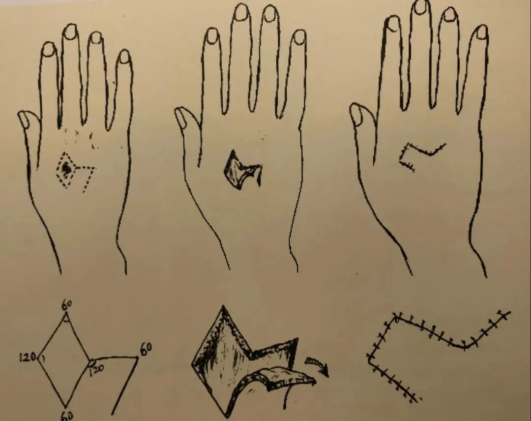 为什么要结扎血管谈骨论筋丨最全的外科手术基本功，别怪我没告诉你！_https://www.jmylbn.com_新闻资讯_第34张