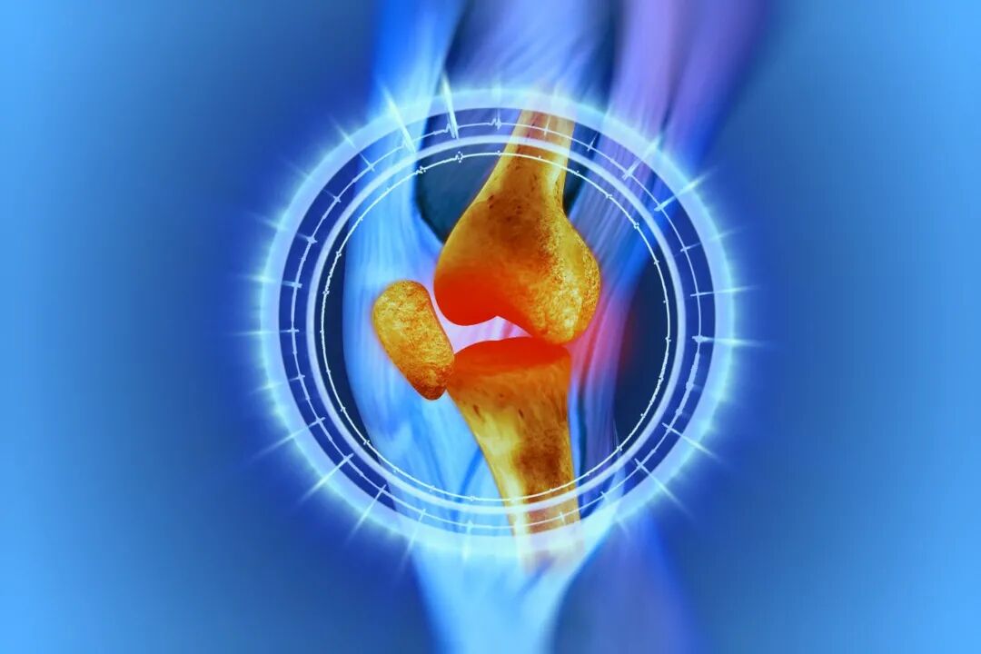 膝骨关节炎的“金字塔”三级疗法，每个都很重要！