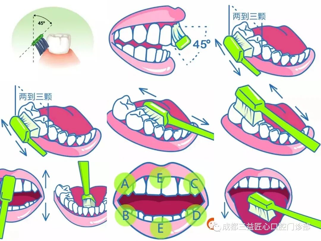六,提倡用水平颤动拂刷法刷牙清水漱口可清除口腔内的食物残渣,但其