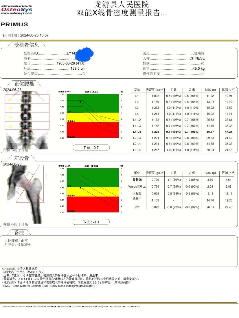 双能x骨密度检测仪为什么非得输入体重身高双能X射线检测骨密度仪，为您的健康加“骨”劲！_https://www.jmylbn.com_新闻资讯_第13张