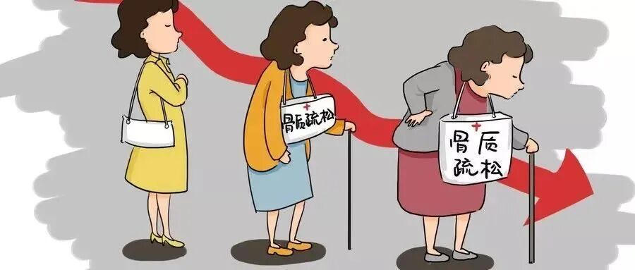 双能x骨密度检测仪为什么非得输入体重身高双能X射线检测骨密度仪，为您的健康加“骨”劲！_https://www.jmylbn.com_新闻资讯_第4张