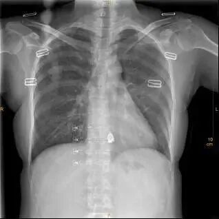 X光拍片为什么要等【影像科普】拍片为什么会要求脱衣服？_https://www.jmylbn.com_新闻资讯_第9张