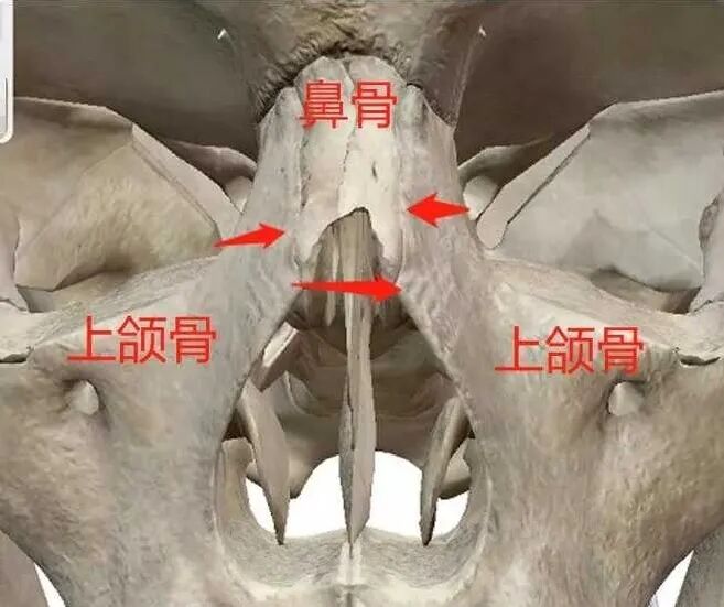 九院韦敏科普丨鼻子会随着年龄增长变大变丑吗 应该如何改善 上海九院韦敏技术团队 微信公众号文章阅读