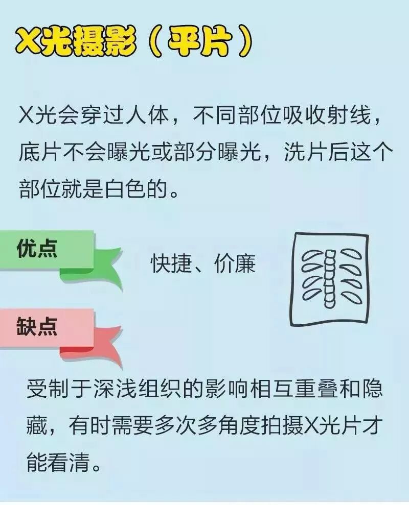 x光是什么原理漫说X光、CT、核磁、B超的原理及作用！_https://www.jmylbn.com_新闻资讯_第10张
