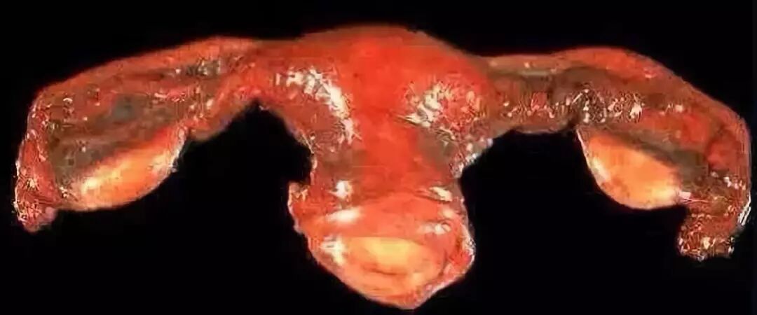 多图科普识你的卵巢