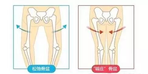 如果骨盆歪斜,下腹部两侧的肌肉就会不平衡,造成一侧下腹明显突出