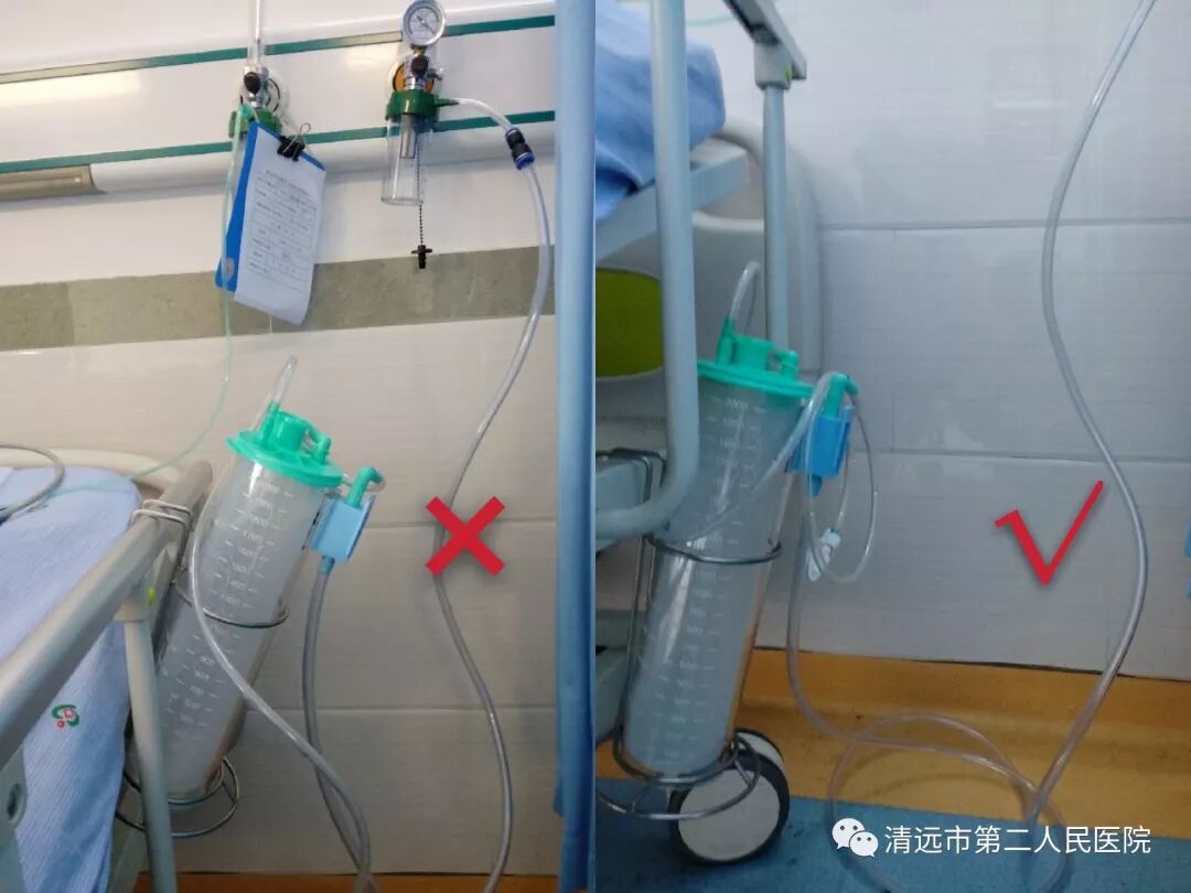 吸痰装置怎么连接中心负压吸引系统在呼吸内科正式投入使用_https://www.jmylbn.com_新闻资讯_第2张