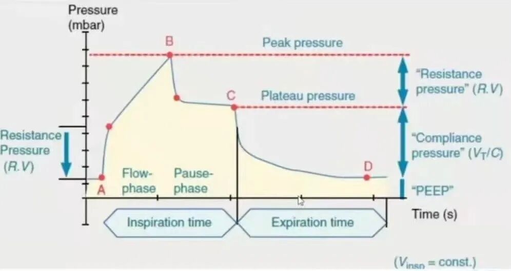 呼吸机pip是什么意思呼吸机参数之峰压（PIP）与平台压（Pplat）_https://www.jmylbn.com_新闻资讯_第1张