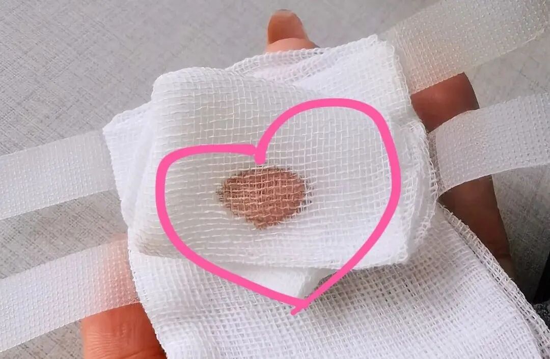 医院DR怎么消毒液体创可贴：促进湿性愈合，消毒防护，有娃必备！_https://www.jmylbn.com_新闻资讯_第1张