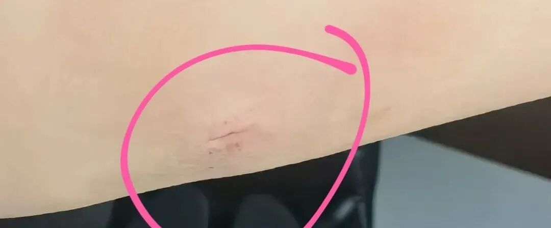 医院DR怎么消毒液体创可贴：促进湿性愈合，消毒防护，有娃必备！_https://www.jmylbn.com_新闻资讯_第2张