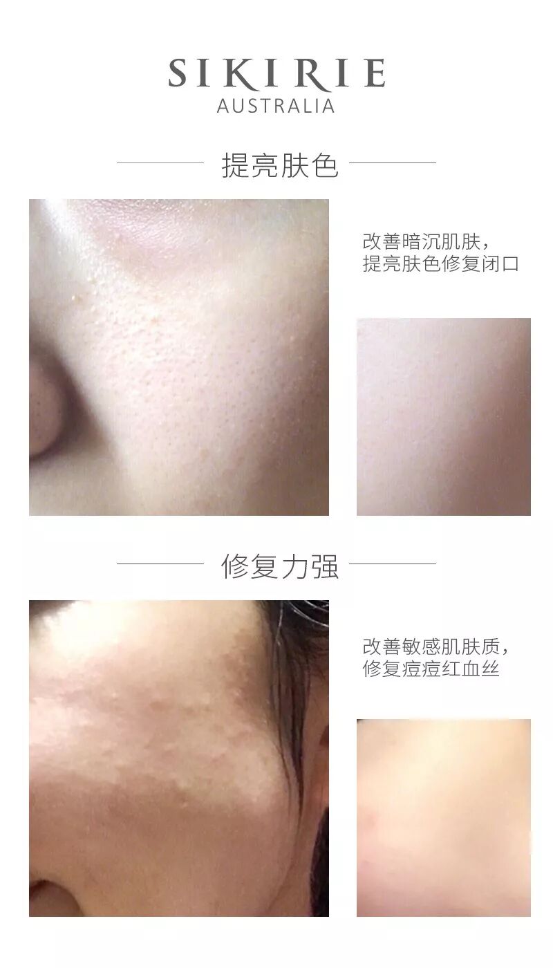 %name 娘娘蔡少芬惊现悉尼！美艳如18岁！皮肤细嫩身材窈窕！她，为澳洲华人女性带来终极美丽秘密！