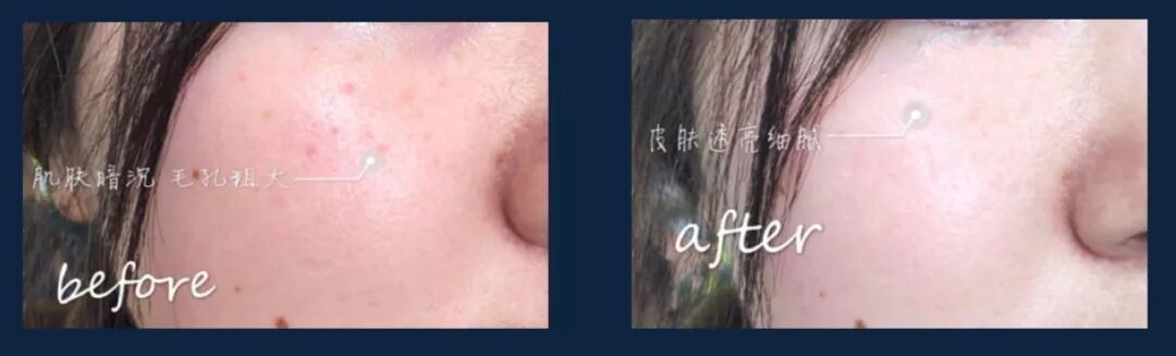 %name 娘娘蔡少芬惊现悉尼！美艳如18岁！皮肤细嫩身材窈窕！她，为澳洲华人女性带来终极美丽秘密！