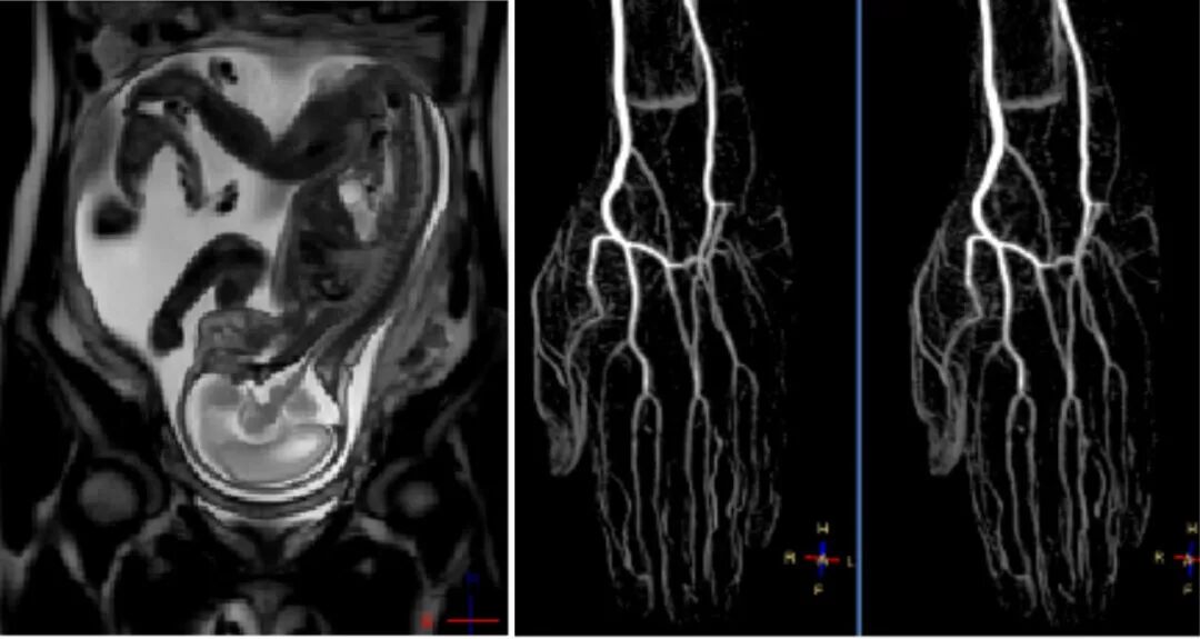 医用仪器有哪些能透视让疾病无处遁形，带你瞧瞧医院里的“火眼金睛”_https://www.jmylbn.com_新闻资讯_第8张