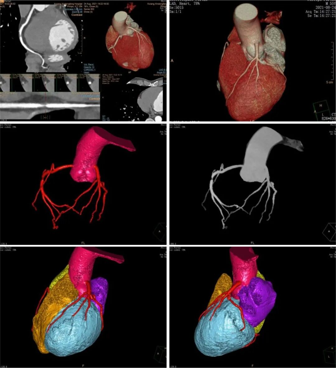 医用仪器有哪些能透视让疾病无处遁形，带你瞧瞧医院里的“火眼金睛”_https://www.jmylbn.com_新闻资讯_第3张