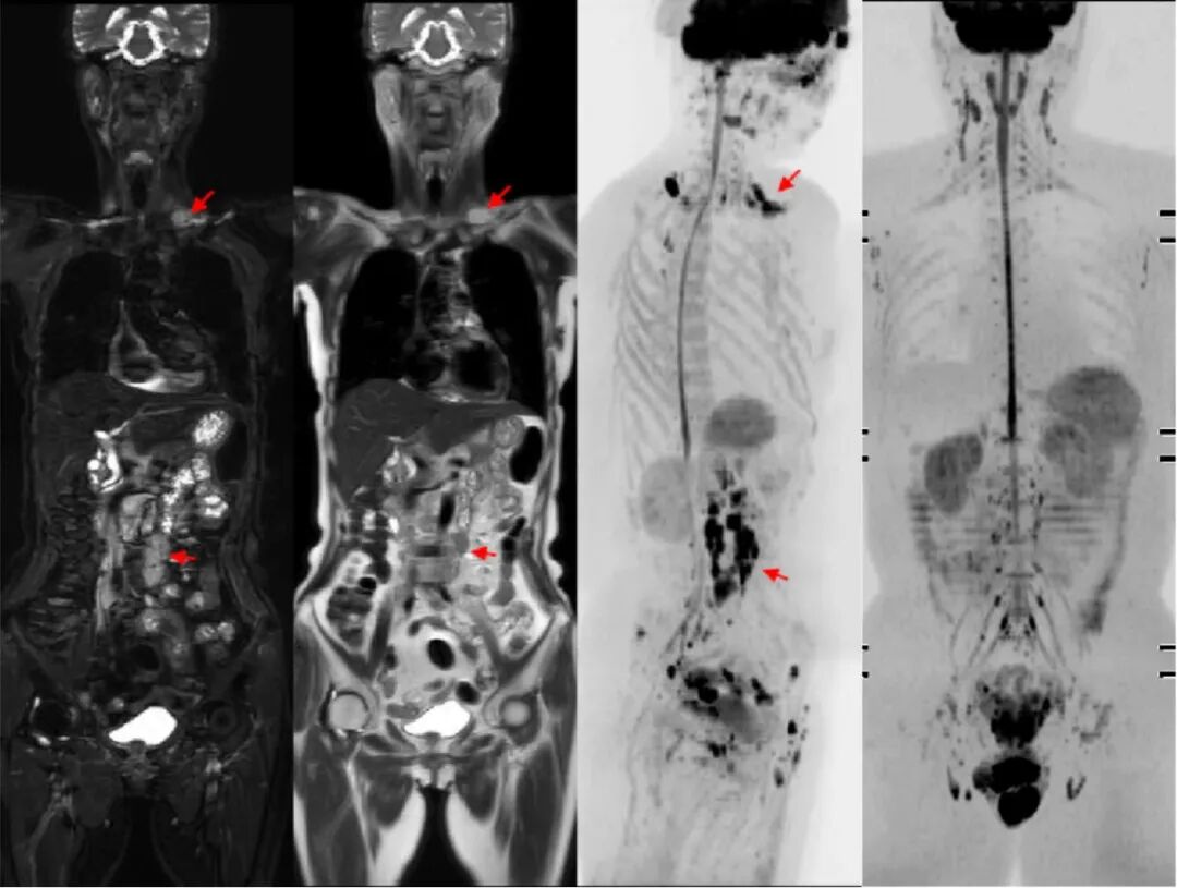 医用仪器有哪些能透视让疾病无处遁形，带你瞧瞧医院里的“火眼金睛”_https://www.jmylbn.com_新闻资讯_第5张