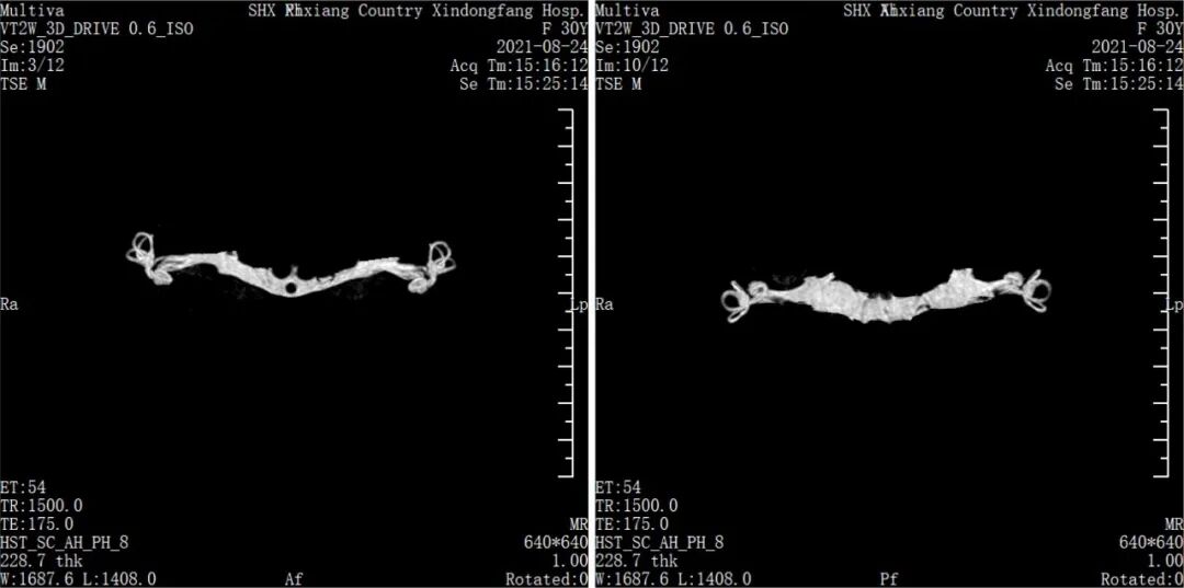 医用仪器有哪些能透视让疾病无处遁形，带你瞧瞧医院里的“火眼金睛”_https://www.jmylbn.com_新闻资讯_第6张