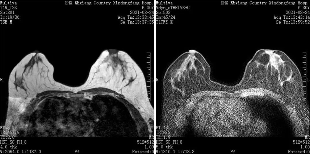 医用仪器有哪些能透视让疾病无处遁形，带你瞧瞧医院里的“火眼金睛”_https://www.jmylbn.com_新闻资讯_第7张