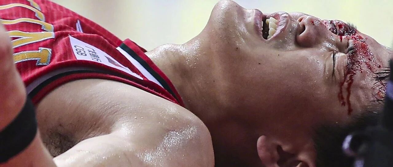 罕见直播中插入伤势报道！这飙血画面不忍直视...为状元祈祷！