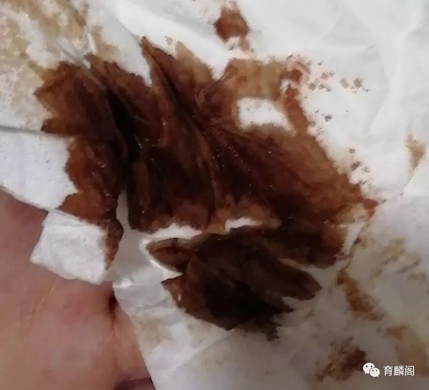 产前检查_产前检查疾病介绍 - 好大夫在线