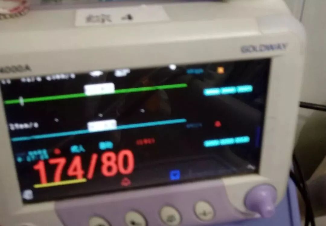 病人监护仪怎么用带您认识监护仪上的数值_https://www.jmylbn.com_新闻资讯_第2张