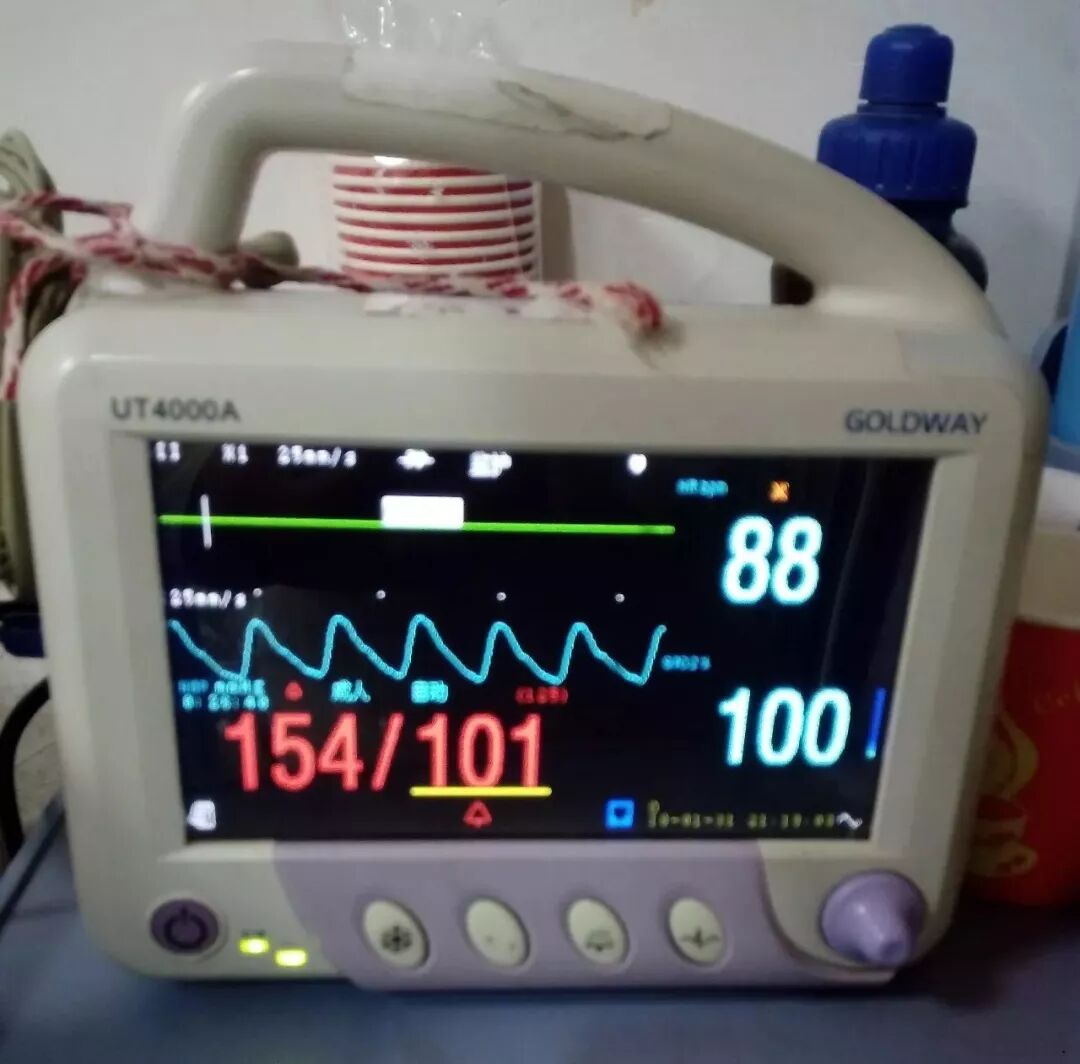 病人监护仪怎么用带您认识监护仪上的数值_https://www.jmylbn.com_新闻资讯_第1张