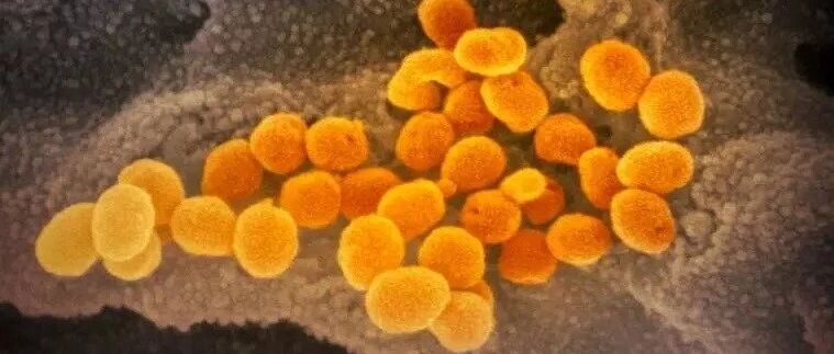 《科学》子刊：我国科学家揭示新冠肺炎的潜伏期中位数为7.76天，而不是4~5天