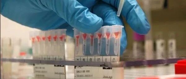 O型血的人不易患痴呆？血型对于机体健康到底有多重要？