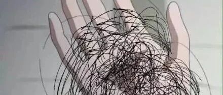 每天睡10小时，28岁小伙儿没想到还是秃了......