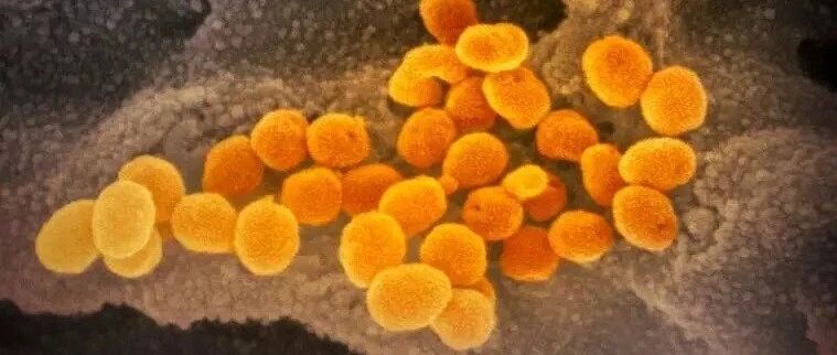 新发现！JAMA揭示：重度新冠肺炎的年轻人中或存在遗传变异