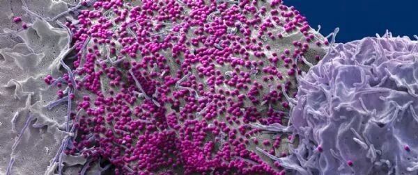 《科学》：史上第三例被治愈的艾滋病患者真的出现了么？