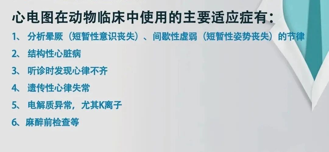 心电图滤波怎么选择【知跃干货】心电图基本示例_https://www.jmylbn.com_新闻资讯_第4张