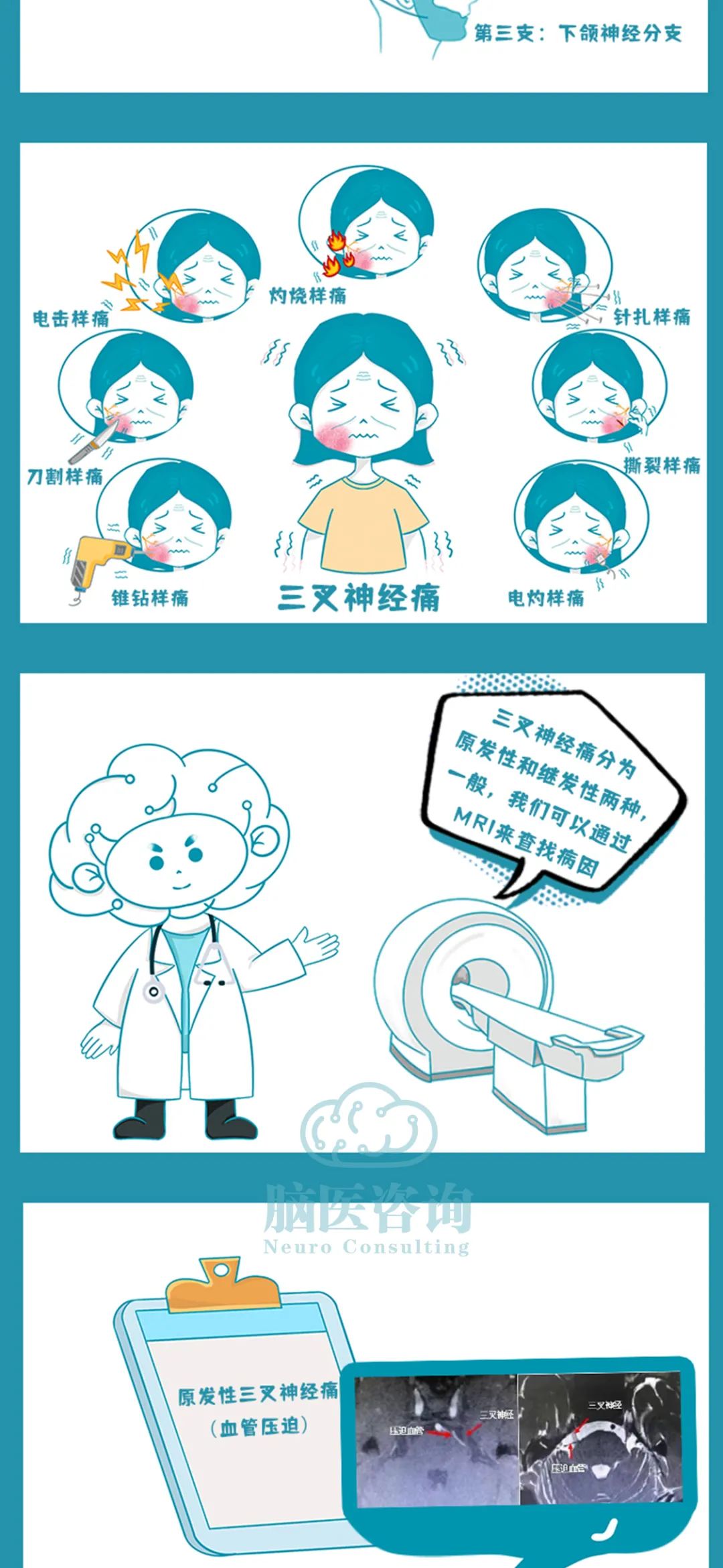 脑博士no1天下第一痛三叉神经痛