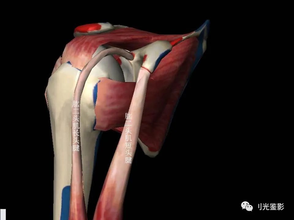 肩关节MRI解剖肩袖损伤诊断技巧--对应动图，效果超赞