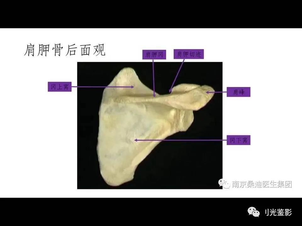 肩关节MRI解剖肩袖损伤诊断技巧--对应动图，效果超赞