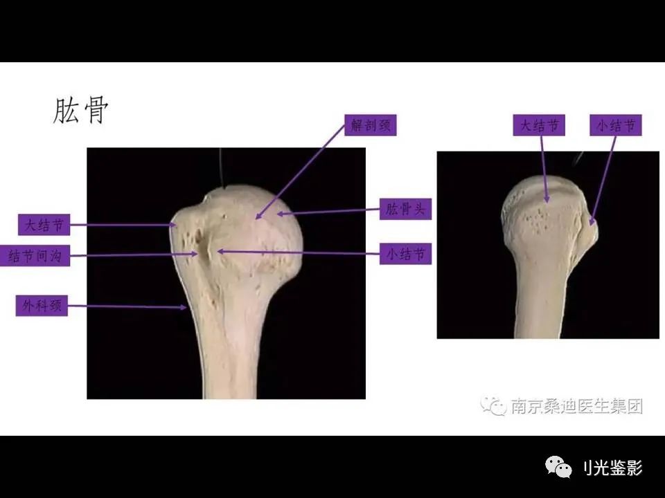 肩关节MRI解剖肩袖损伤诊断技巧--对应动图，效果超赞
