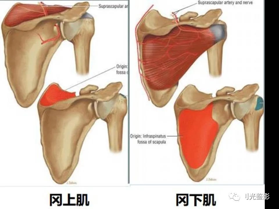 肩关节MRI解剖肩袖损伤诊断技巧--对应动图，效果超赞