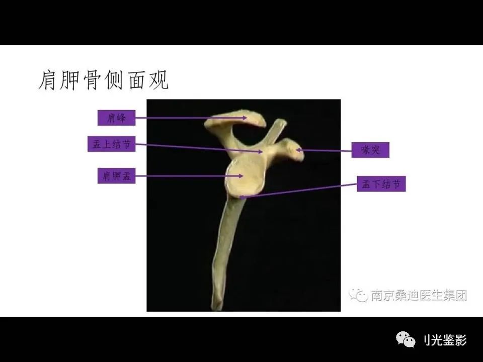 肩关节MRI解剖肩袖损伤诊断技巧--对应动图，效果超赞
