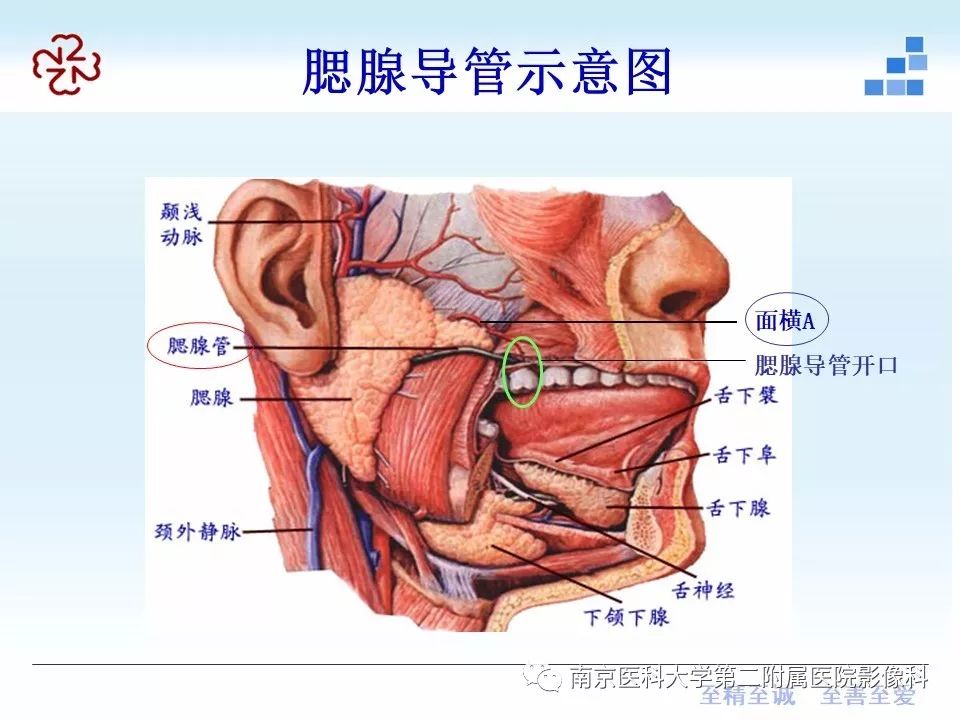 腮腺图片位置示意图图片